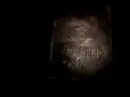 HIM -  The Kiss Of Dawn