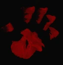 Blood Smear