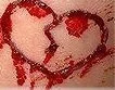My BlOoDy BrOkEn HEART