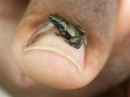 Frogg...