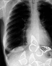 butterflies.