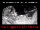 Pro Life