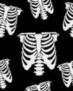 Ribcage