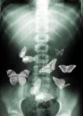 butterflies in stomach