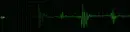 green pulse