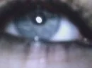 natural blue  eye