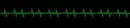 Pulse.