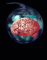 throbbing brain