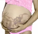 3-d belly