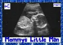 Sonogram- Mommy's Little Man