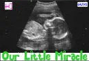 Sonogram- Our Little Miracle