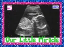 Sonogram (with boarder)- Our Little Miracle