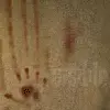 Scars