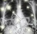 Butterflies in the stomach
