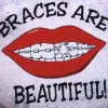 Brace are beauty