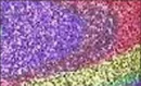 Glittery
