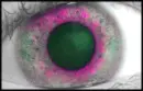eye