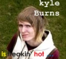 kyle burns!!