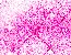 Starry StarKing - Pink Starry