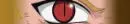 Red eye