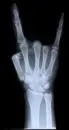 rock