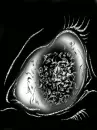 eye