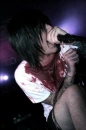 Oli Sykes