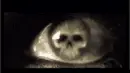 Skull Eye