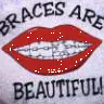braces are beautiful