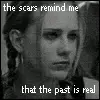 scars