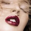 red fever