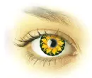 Eye 