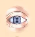 sad eye