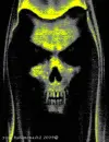 the angel of death