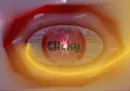 clicky