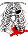 ribs