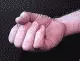 Hand