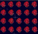 red rosses
