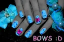 Bows