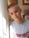 justin bieber no hair