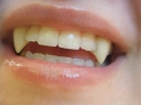 vampire fangs