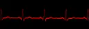 heartbeat