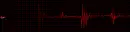 heartbeat