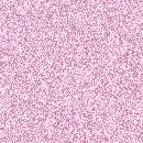 Glitter Pattern