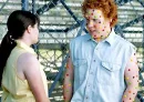 Skittles Pox