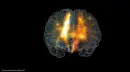 brain