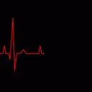 EKG
