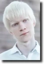 albino