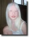 albino