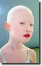 albino